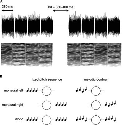 Neuromagnetic representation of melodic contour processing in human auditory cortex